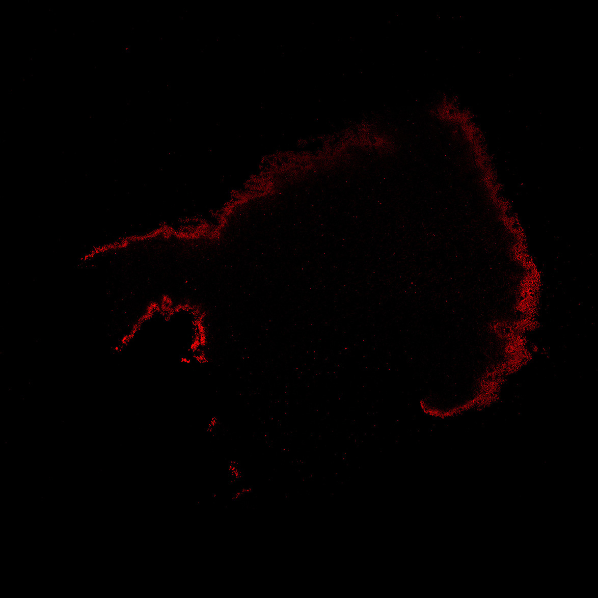 Human foetal midbrain
